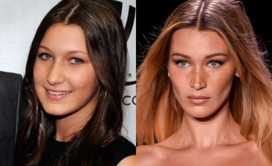 bella hadid before and after